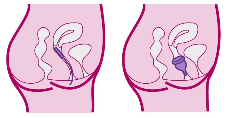 Os copos menstruais têm quatro tamanhos