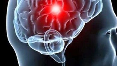 10 Alimentos que reduzem risco de AVC (acidente vascular cerebral)